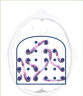 A brain with a diagram Description automatically generated with medium confidence
